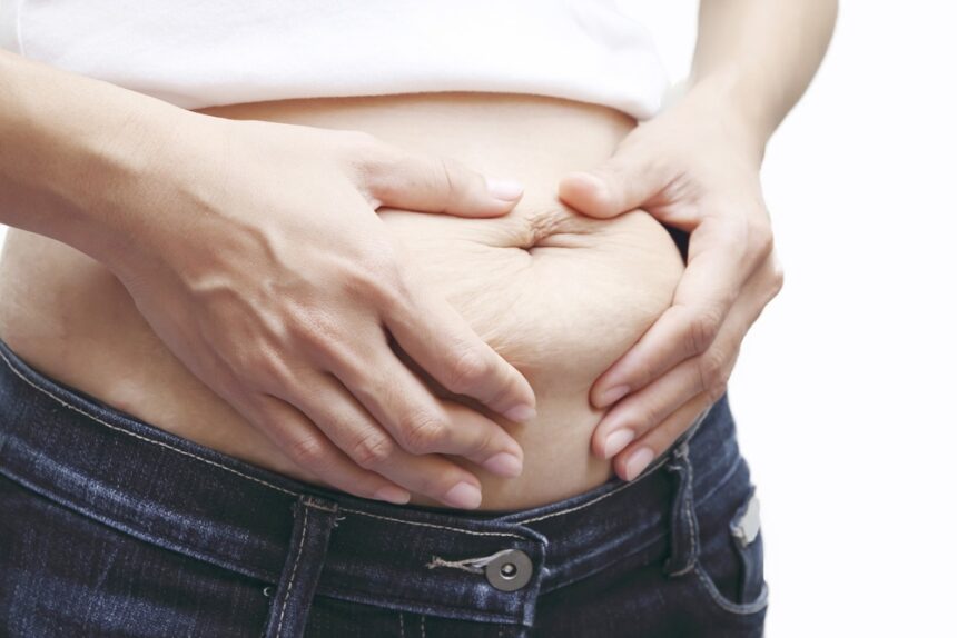 Merging Traditional and Modern Approaches to Belly Fat Removal in Dubai