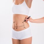 Liposuction in Islamabad: What You Need to Know