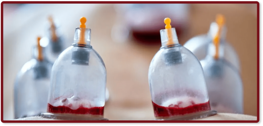 hijAMA