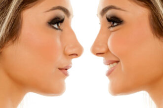 Rhinoplasty in Riyadh