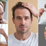 Hair Loss Solutions: