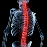 Global Chronic Lower Back Pain Treatment Market