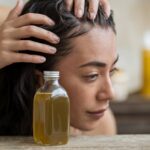 Home Remedies for Dandruff